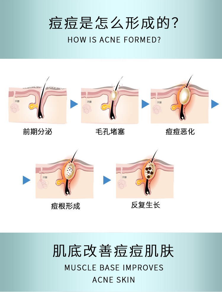 祛痘精华液_02.jpg