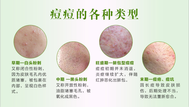 1512636245120824.png 2.png