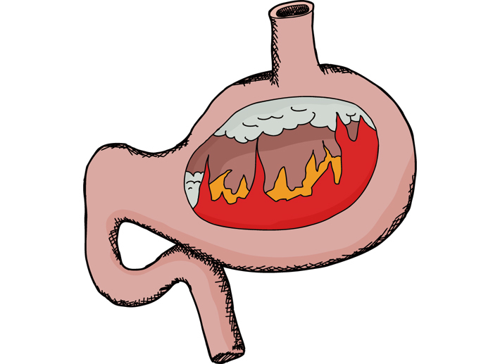 肠胃常不适，口臭，腹泻、便秘等都是肠道菌群失调惹的祸！