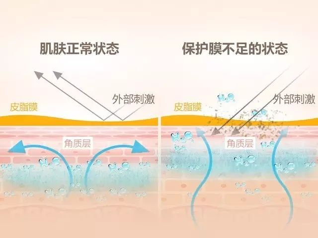 祛除痘痘一步到位